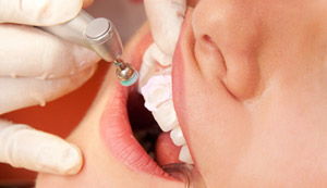 Clareamentos dentários de consultório com controle e segurança