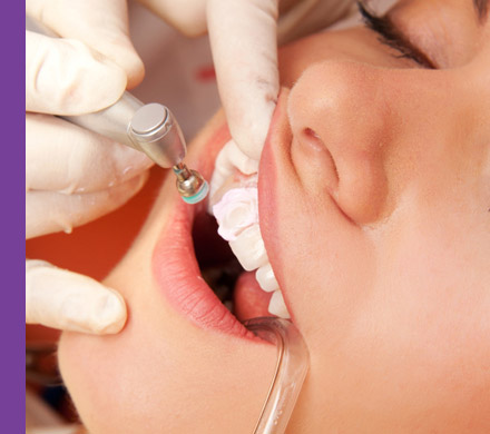 Clareamentos dentários de consultório com controle e segurança