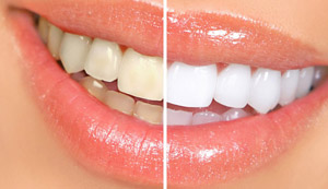 Odontologia clínica restauradora e estética
