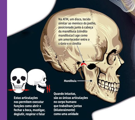 Articulação estalando é sempre sintoma de DTM?