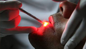 Terapia fotodinâmica antibacteriana ideal para pós-tratamentos periodontais